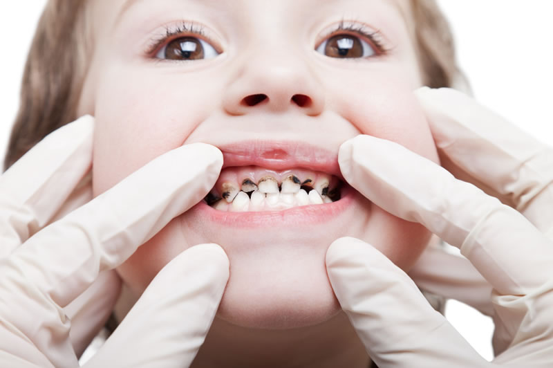 Children’s Dentistry