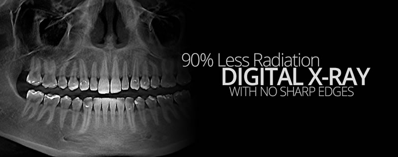 Digital X-Rays - Brampton - Starbrite Dental